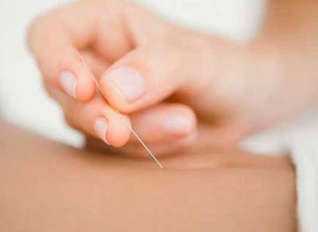 การ ฝังเข็มเพิ่มความสูง ทำได้ในทุกช่วงอายุไหม  